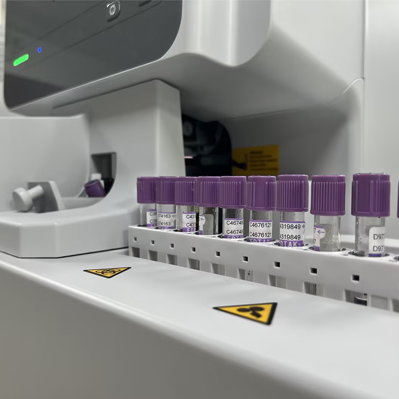 5-Part Auto Hematology Analyzer BH-HA650